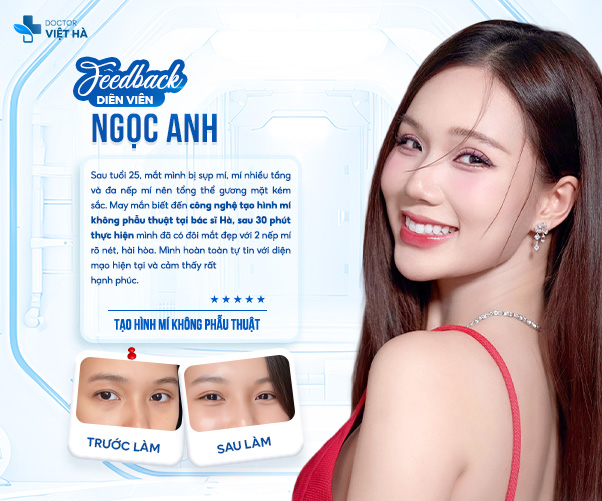 Diễn viên Ngọc Anh